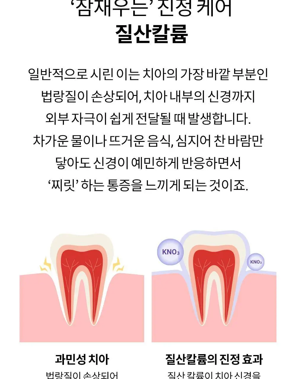 [고불소] 언파 차차 프로 시린이 케어 차콜치약 100g 상세페이지 11